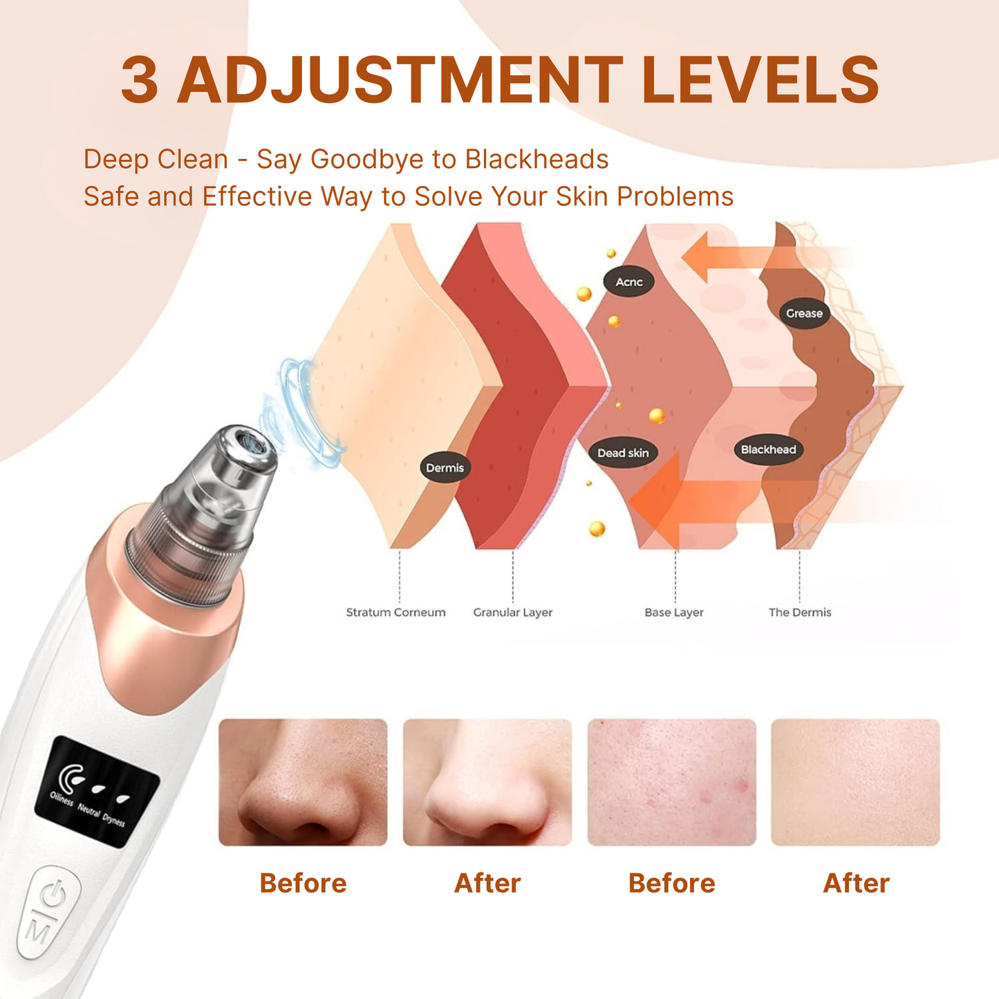 Glow Genie™ Pore Vacuum