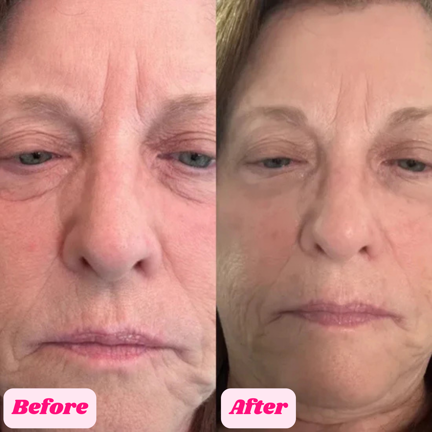 GlowUp™ Cemenrate Calcium Multi Balm