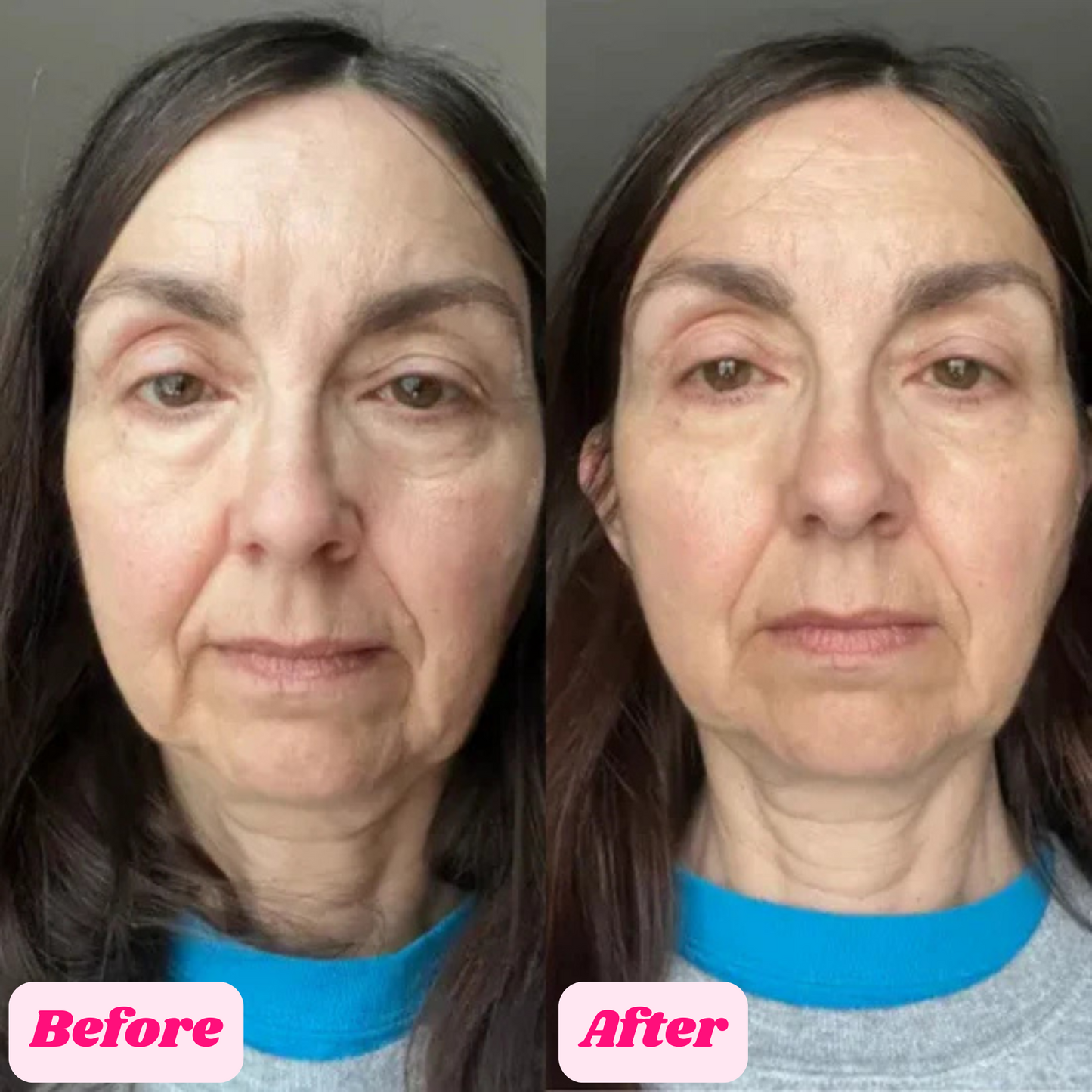 GlowUp™ Cemenrate Calcium Multi Balm