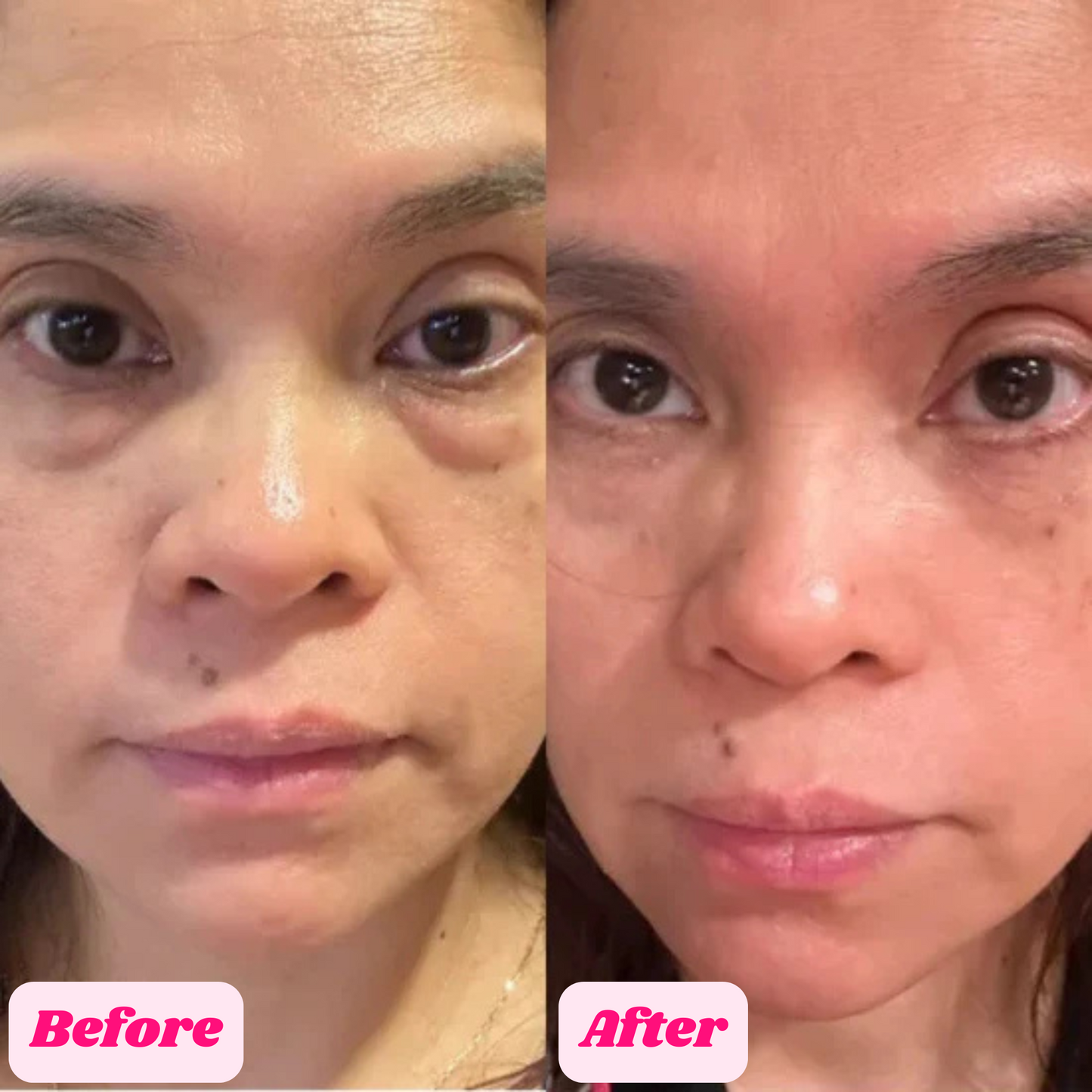 GlowUp™ Cemenrate Calcium Multi Balm